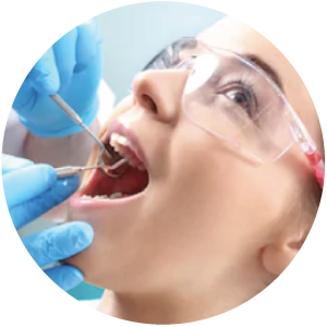 Cavities Treatment at Stayner Dental